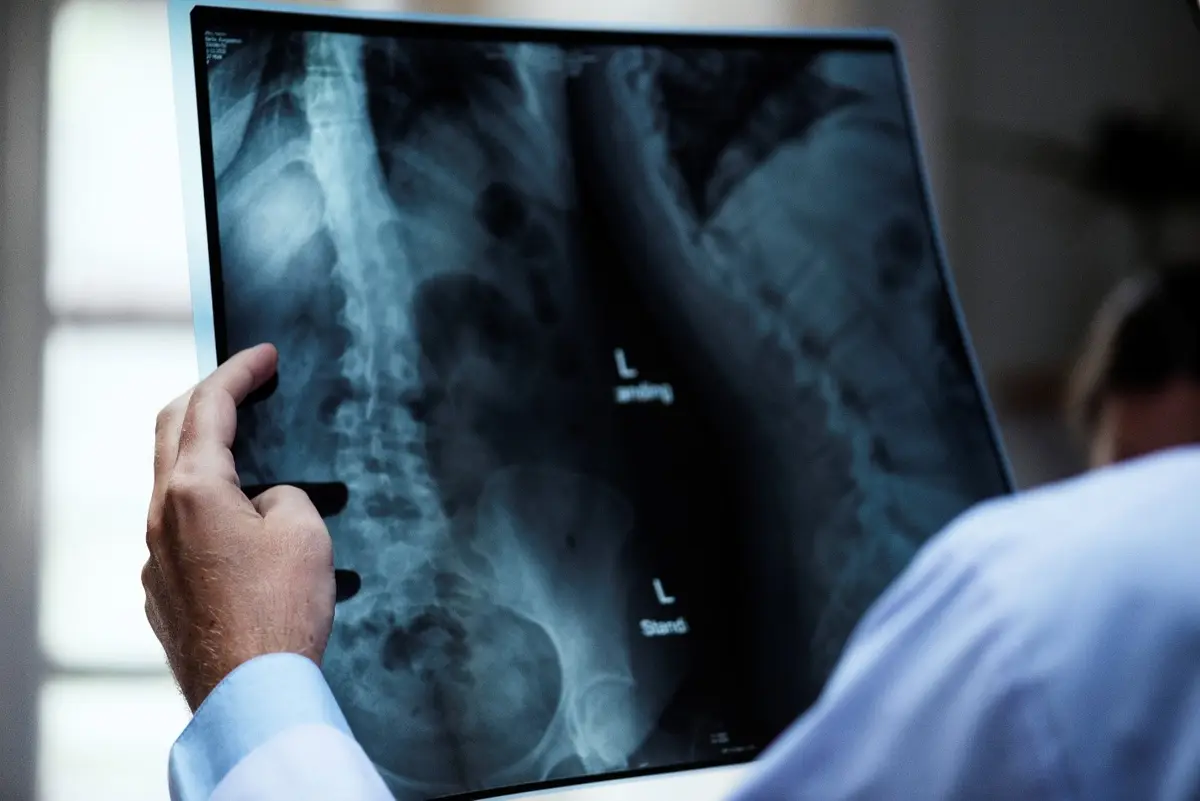 The Purpose of Acute and Chronic Pain